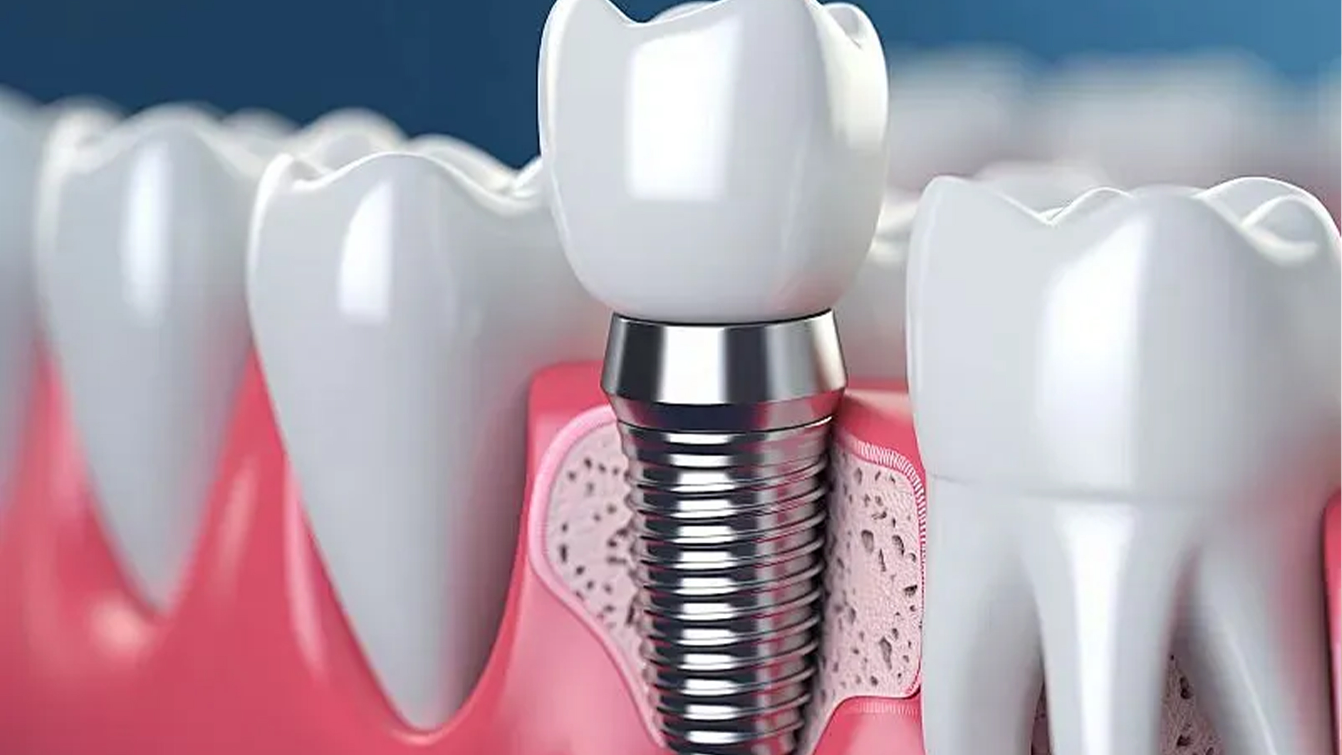 Advances In The Immune Response And Treatment Of Intervertebral Discs