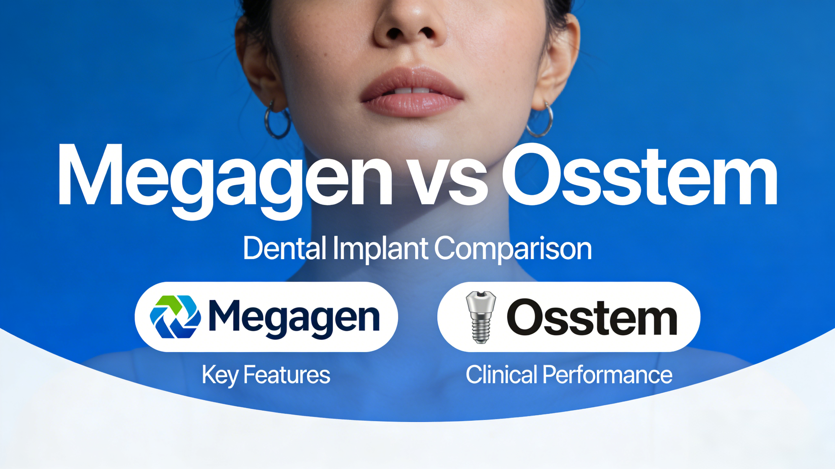Megagen vs Osstem Dental Implants: Design, Surface & Clinical Comparison
