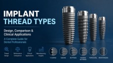 Implant Thread Types Explained: Design, Comparison & Clinical Applications for Dental Professionals