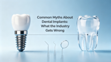 Common Myths About Dental Implants: What Clinics and Buyers Often Get Wrong