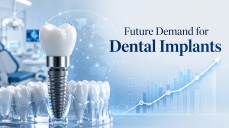 Future Demand for Dental Implants: Market Growth, Patient Needs, and B2B Opportunities