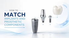 How to Match Implants and Prosthetic Components: Complete Guide for Clinics and Labs