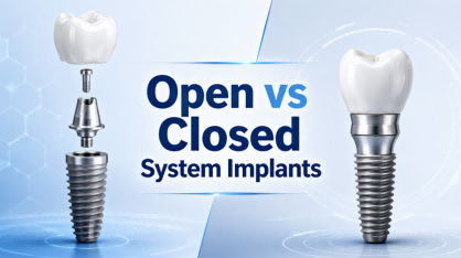 Open System vs Closed System Implants: Which Dental Implant Platform Is Better for Clinics, Labs, and Distributors?